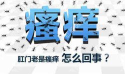 肛門瘙癢治不好嗎？先檢查病因就好辦！